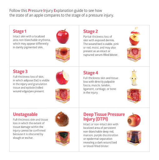 Apple PIE Chart