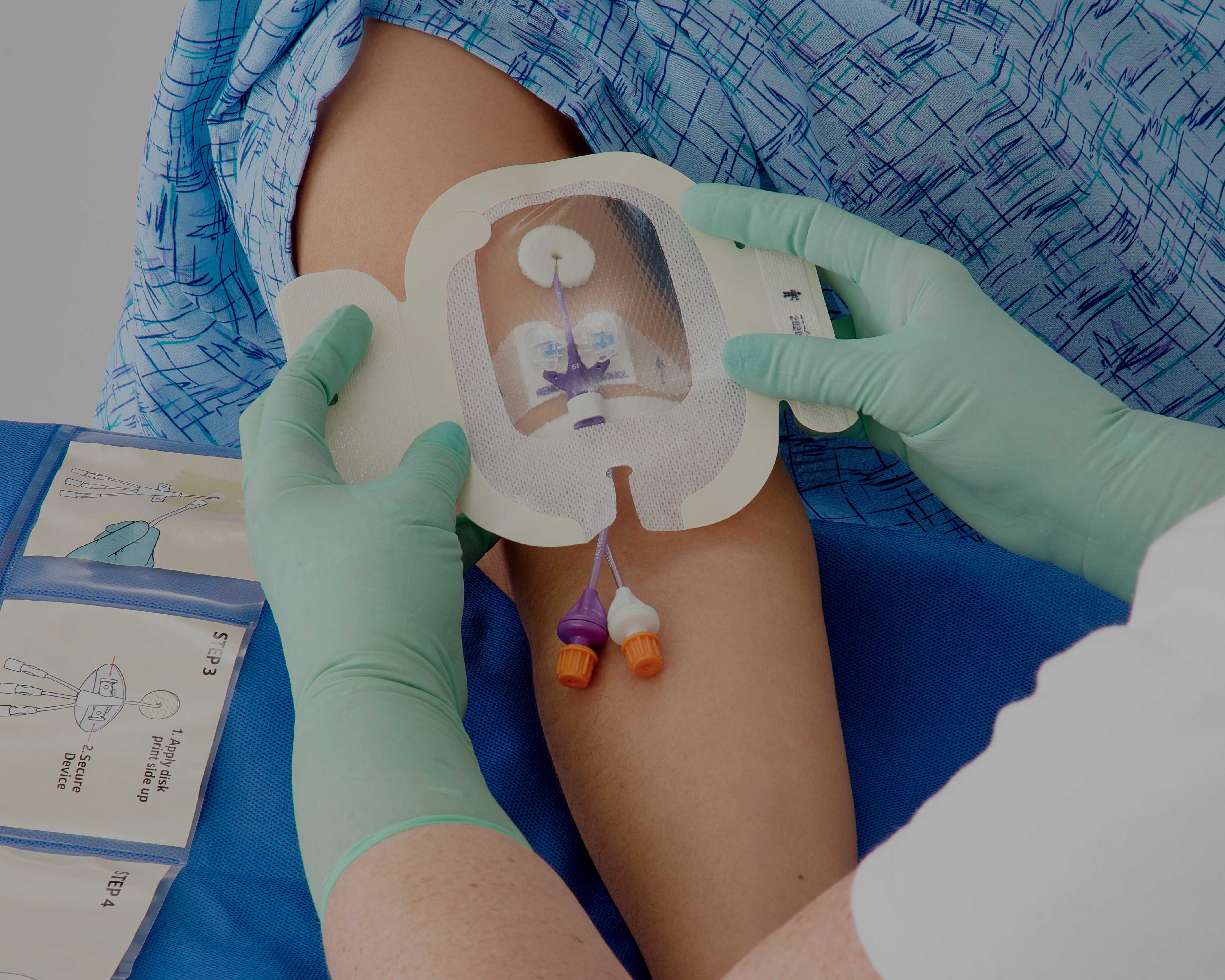 image of PICC line being inserted into arm